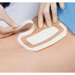 Tegaderm +Pad | 9cm x 25cm | 25pcs
